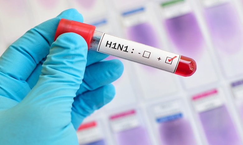 تفاصيل جديدة للحالات المصابة بفيروس ” H1 N1 ” بأكادير