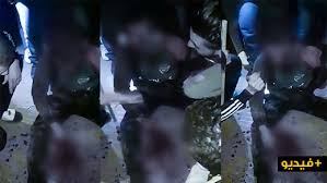 انزكان : إنقاذ شخص من عملية “كريساج” بعد محاصرة مواطنين للسارق مسلح بسكين