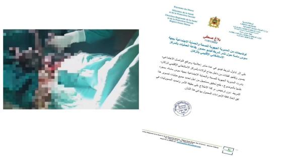 مديرية الصحة تفتح تحقيقا في فضيحة “ روتيني اليومي” بمستشفى إنزكان