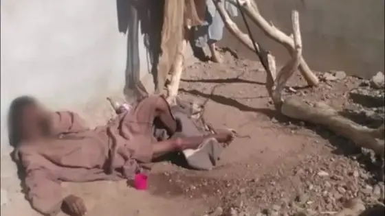 تارودانت : العثور على شاب مكبل بالسلاسل لازيد من 4 سنوات