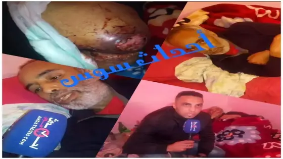 بالفيديو .. سعيد مواطن من أكادير يناشد وزير الصحة راه الدود كيأكلني وجراو عليا من السبيطار