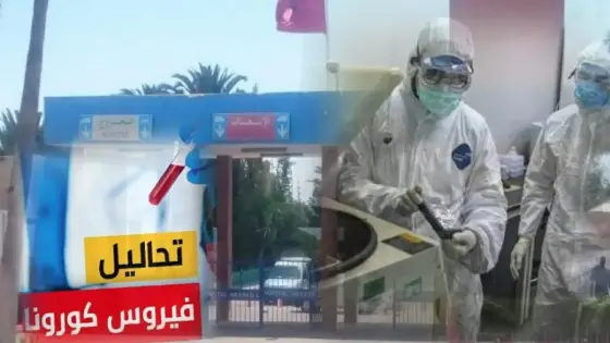أكادير – كورونا :من بينهم سيدتين من ايت ملول والتمسية.. المستشفى الجهوي يستقبل 4 حالات و النتائج المخبرية بشرت بالخير لسلبية التحاليل