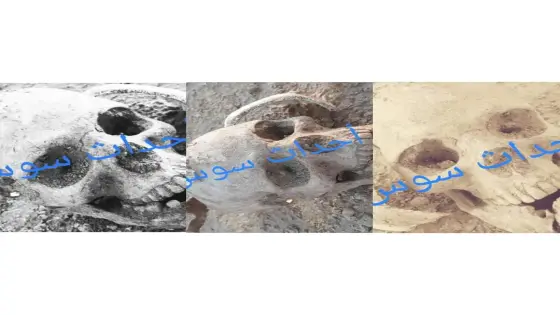 أكادير بالصور .. العثور على بقايا عظام بشرية قرب مطرح النفايات