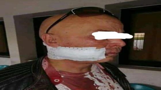 كورتي يشرمل مدير المحطة الطرقية ويرسله للمستعجلات