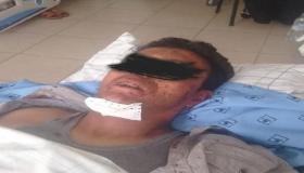 عسكري يبتر عضو ذكري لشخص وجده في منزله مع زوجته في وضعية مخلة بالحياء