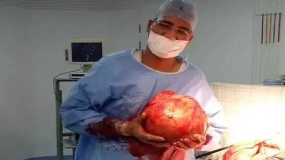 الصويرة :  الدكتور محمد بن جلون ينجح في استئصال ورم ضخم في كلية مسن