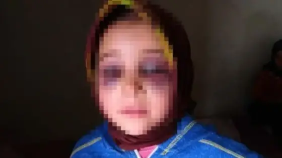 الوزارة تدخل على الخط في قضية تعنيف استاذ الواجبات المنزلية لتلميذته والدرك يحقق في القضية