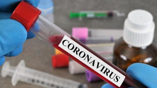 “كورونا”.. هكذا تتم عملية تشخيص الإصابة بفيروس كورونا بالمختبرات المغربية