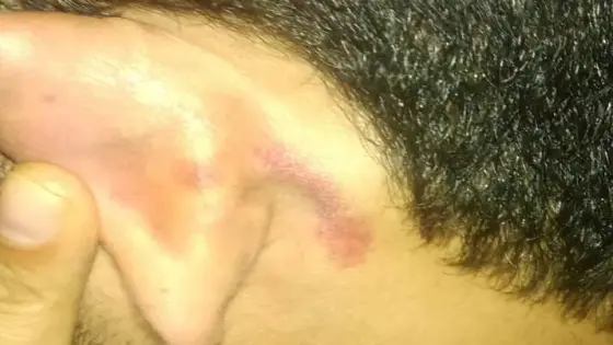 نائب رئيس جماعة ايت عميرة يعتدي على على عضو الحزب الاشتراكي الموحد بمقر عمله.