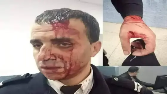 توقيف شقيقين للاشتباه في تورطهما في محاولة السرقة تحت التهديد والضرب والجرح بواسطة السلاح الأبيض
