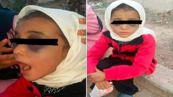 مديرية التعليم بتارودانت تصدر بيان حقيقة حول واقعة تعنيف تلميذة باحدى فرعيات الاقليم
