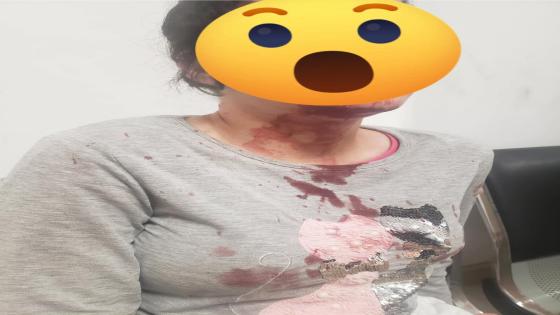 أيت ملول.. جارة تعتدي بالسلاح الأبيض على قاصر والمنظمة الوطنية تدخل على الخط