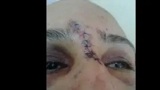 المصالح الأمنية بالبيضاء تتفاعل مع صورة السيدة ضحية اعتداء “شنيع” على مستوى الأنف