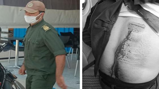 طعن قائد بسلاح أبيض اثناء محاولة هدمه لبناء عشوائي