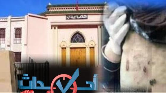تارودانت.. فتح بحث قضائي للتحقق من تورط أبوين في تعريض ابنتهما القاصر للإيذاء العمدي وافتعال حروق (بلاغ)