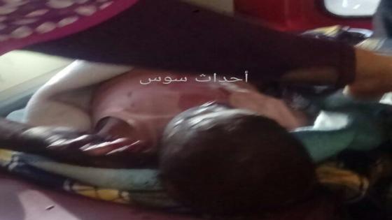 وفاة أحد ضحايا حريق منزل ضواحي اشتوكة