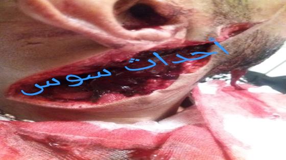 جانح يهاجم شابا بأورير ويرسله إلى المستعجلات في حالة خطيرة
