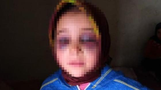 الوزارة تدخل على الخط في قضية تعنيف استاذ الواجبات المنزلية لتلميذته والدرك يحقق في القضية