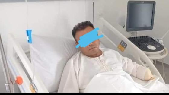 سارق ” بيكوب سكران ” يبثر يد طبيب في حادث مؤلم