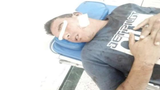 حين تتحول الصداقة إلى عداوة..شاب يتعرض لاعتداء شنيع من طرف صديقه بجماعة الكدية البيضاء ضواحي أولاد تايمة