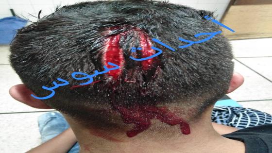 أكادير .. سيارة مجنونة تدهس شابا على طريقة أفلام الأكشن وتلود بالفرار