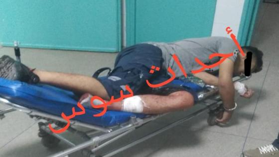 بالصور إطلاق الرصاص وإصابة شرطي إثر تدخل بطولي لتوقيف هائج بإنزكان