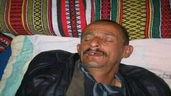 إصابة الفكاهي “الكريمي” بجروح بليغة الخطورة في حادثة سير بجماعة اهديل
