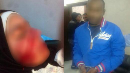 خطير : مسخوط الوالدين شوه وجه والدته بالسلاح الأبيض ضواحي مراكش