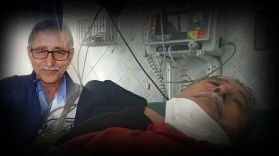 وعكة صحية تدخل الفنان ” احمد بادوج ” مستشفى إنزكان