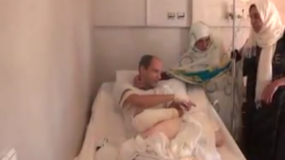 مجرمان يقطعان يد نادل مقهى بايت ملول