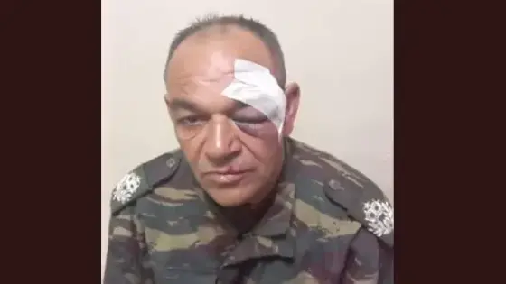 “ولاية أمن الدار البيضاء تستجيب بسرعة لاعتداء جسدي على أحد أعوان السلطة”