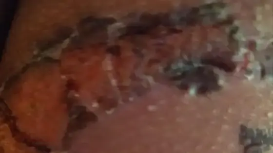 توقيف أم أحرقت إبنتها بمدينة بيوكرى 