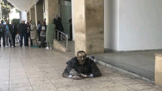 تفاصيل إحراق فنان مسرحي جسمه بالرباط