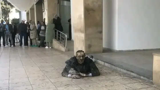 تفاصيل إحراق فنان مسرحي جسمه بالرباط