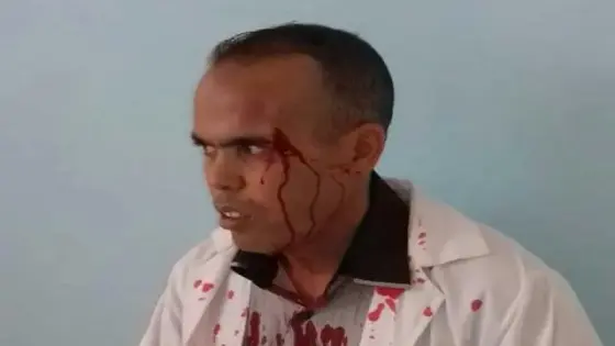 اعتقال شقيق تلميذة دخل ثانوية اعتدى على أستاذ