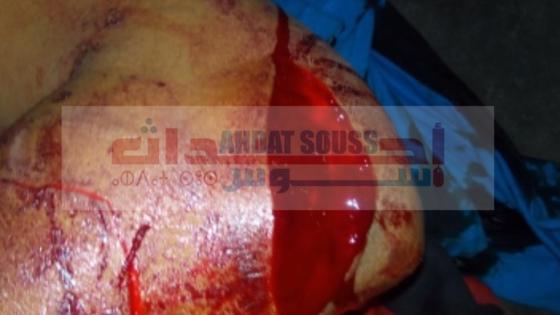 أكادير .. جلسة خمرية بين شابين تنتهي بقسم المستعجلات بمستشفى الحسن الثاني