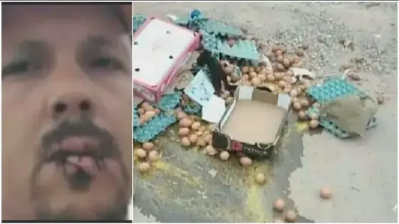 بسبب ” الحكرة ” مواطن يخيط فمه في أورير