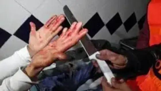 تلميذ يشرمل زميله بالسمارة