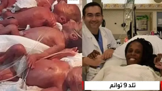 الفحوصات توقعت 7 .. سيدة تنجب 9 مواليد تحت إشراف طاقم طبي من المغرب ومالي