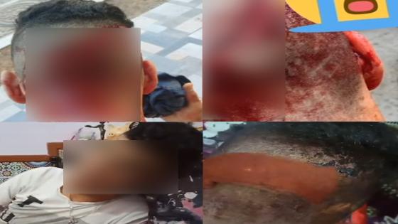 القنيطرة : توقيف جناة عنّفوا شخصا من أجل السرقة