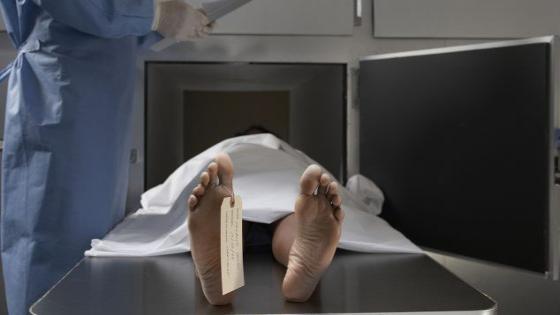 مؤلم .. وفاة الشاب الذي أضرم النار في جسده بتيكوين