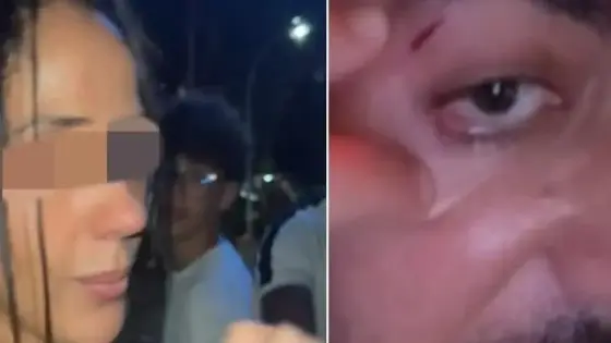 اعتداء على المؤثر المغربي من طرف شابة تُصيبه بجروح تحت تأثير السكر..ومطالب ب 10مليون كتعويض