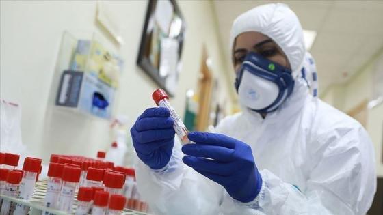 1499 إصابة جديدة و23 حالة وفاة خلال الـ24 ساعة الماضية