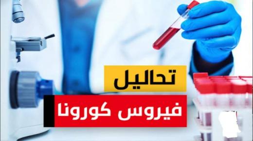 وزارة الصحة المغربية تقدم لائحة المختبرات المرخص لها بالكشف عن فيروس كورونا