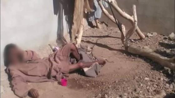 تارودانت : العثور على شاب مكبل بالسلاسل لازيد من 4 سنوات
