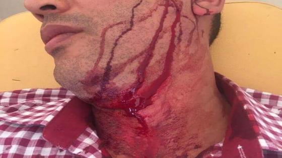 تلميذ يعنف أستاذا رفض السماح له بالغش في امتحان الباكالوريا