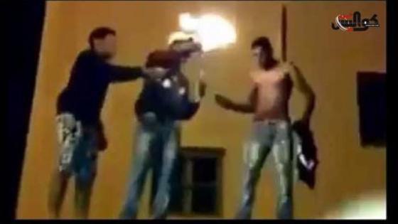 شخص مشبوه يصب مادة مشتعلة على مواطن ويشعل النار في جسده